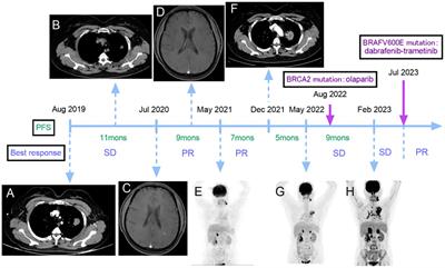 Case report: Dual dabrafenib and trametinib therapy for treating BRAF V600E mutated lung adenocarcinoma with BRCA2 germline mutation post multiline progression